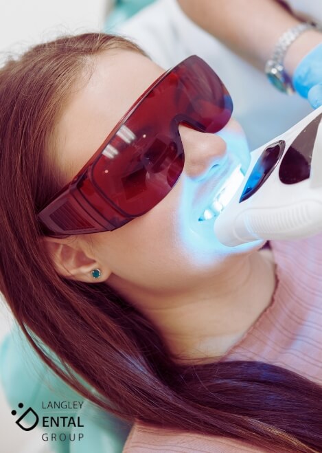 zoom whitening langley