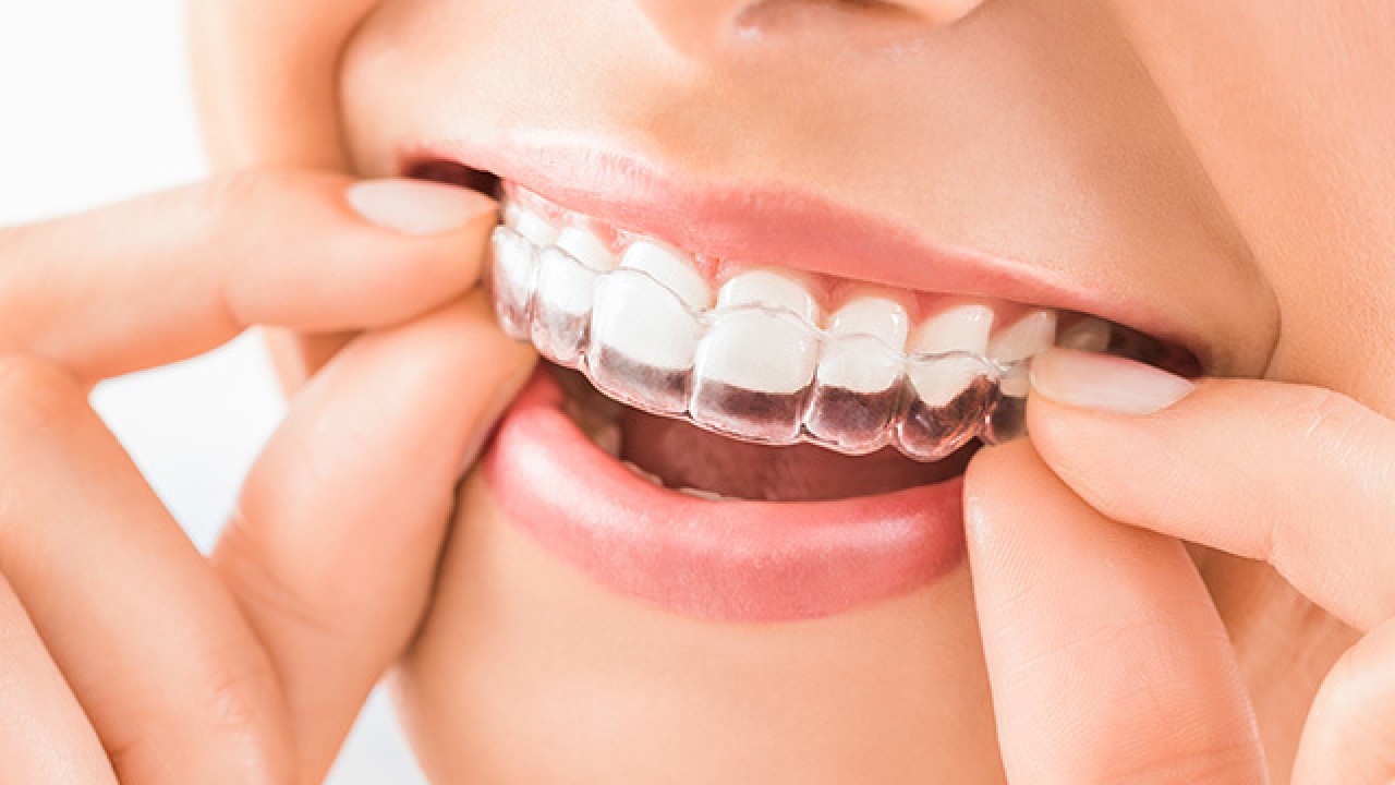 Bruxism Treatment Langley