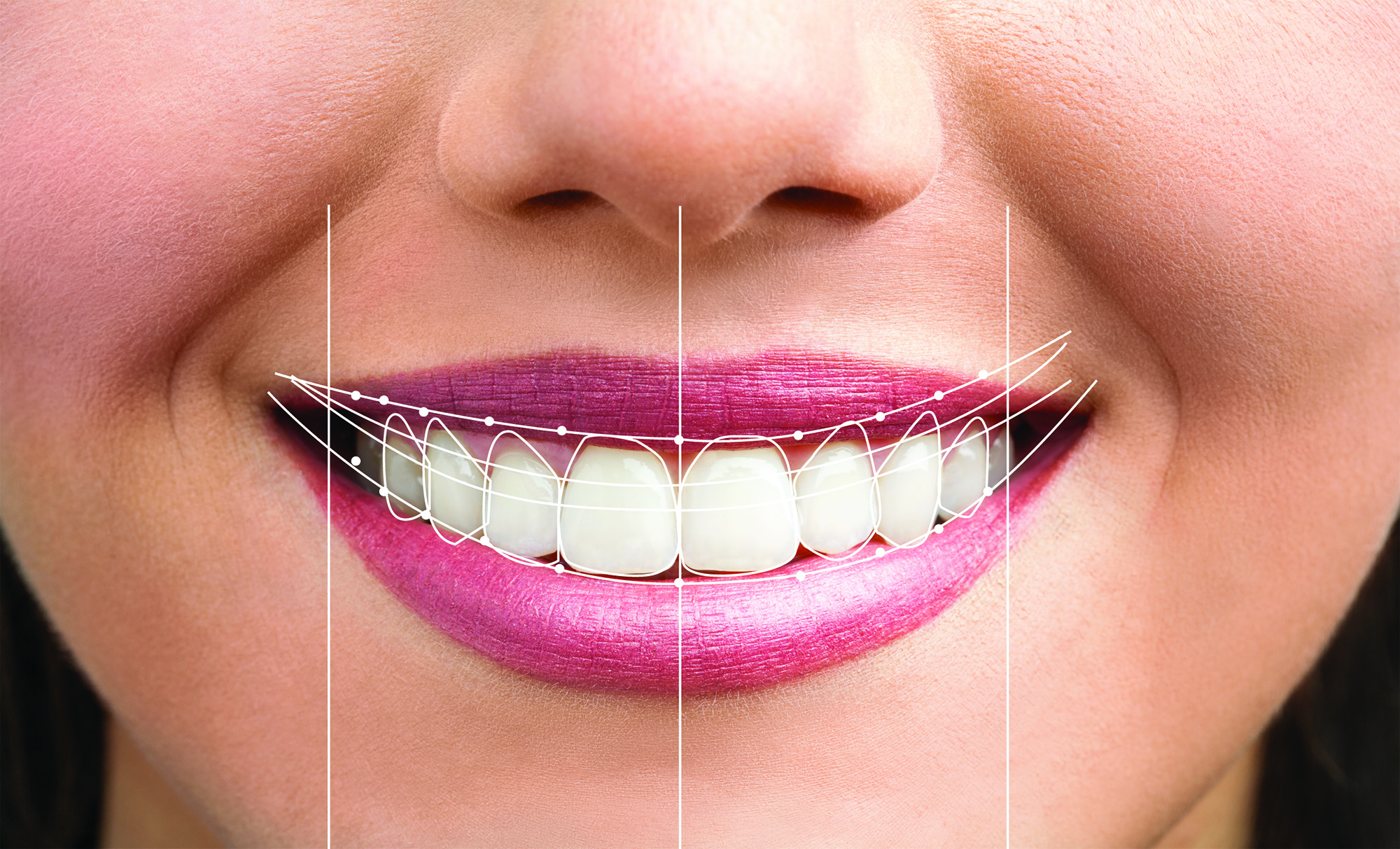 Digital Smile Design #ChangeYourSmileChangeYourLife @ChangeYourSmileChangeYourLife Change your Smile. Change your Life. Beautiful Smile is the “KEY” to professional life, Better job, improve Love life. BEAUTIFUL SMILE BEAUTIFUL LIFE!