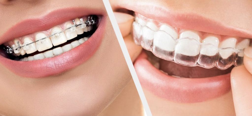 Dr. Tarun Dass Best Orthodontist in Langley