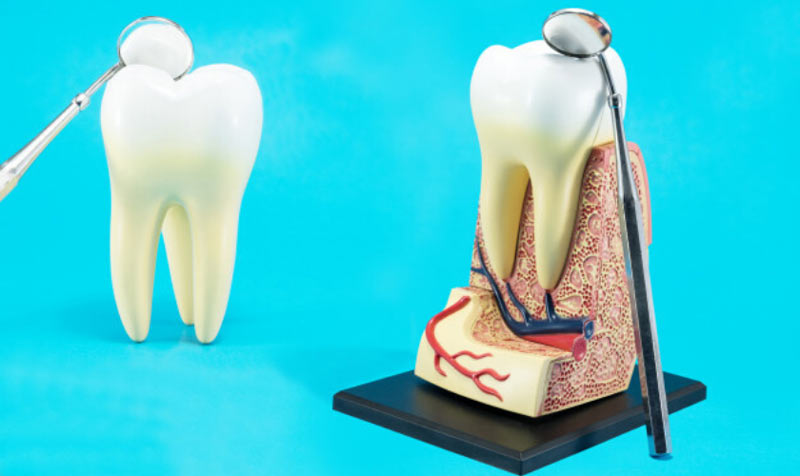 Signs You Need a Root Canal