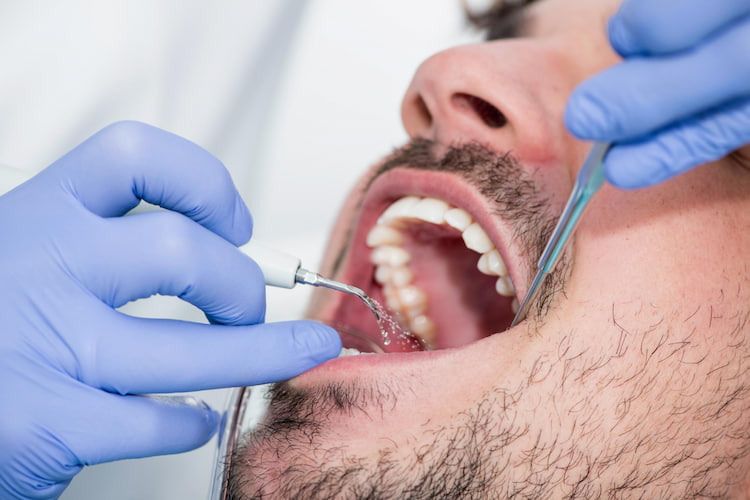 a dentist is cleaning a patient's teeth around the filling.