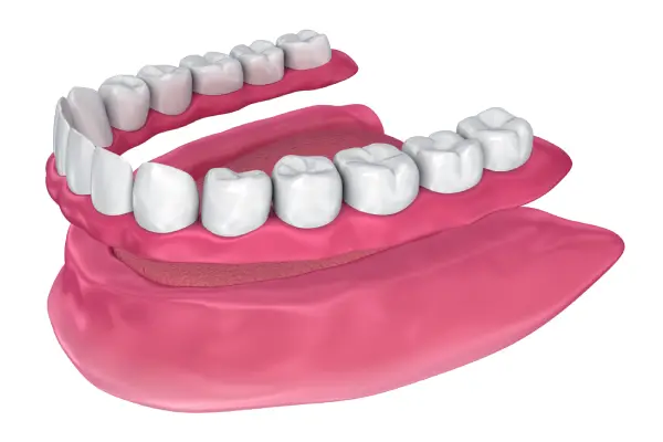denture and it costs