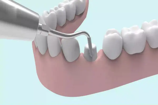 Tooth replica and denture
