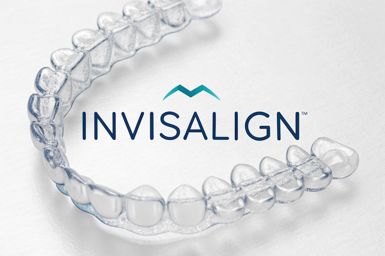 Limitations of Invisalign