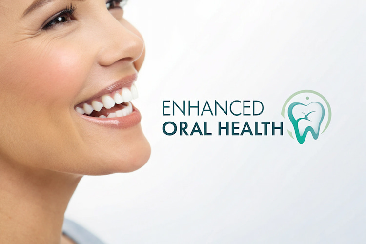 Benefits of Implants with Bone Loss Solutions