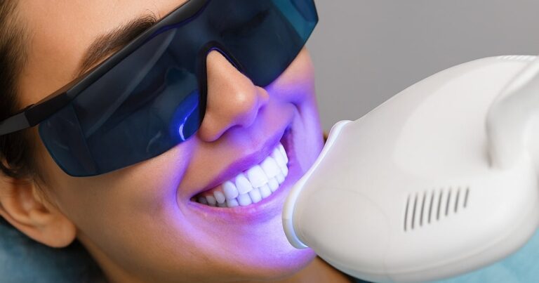How Long Is Teeth Whitening Duration