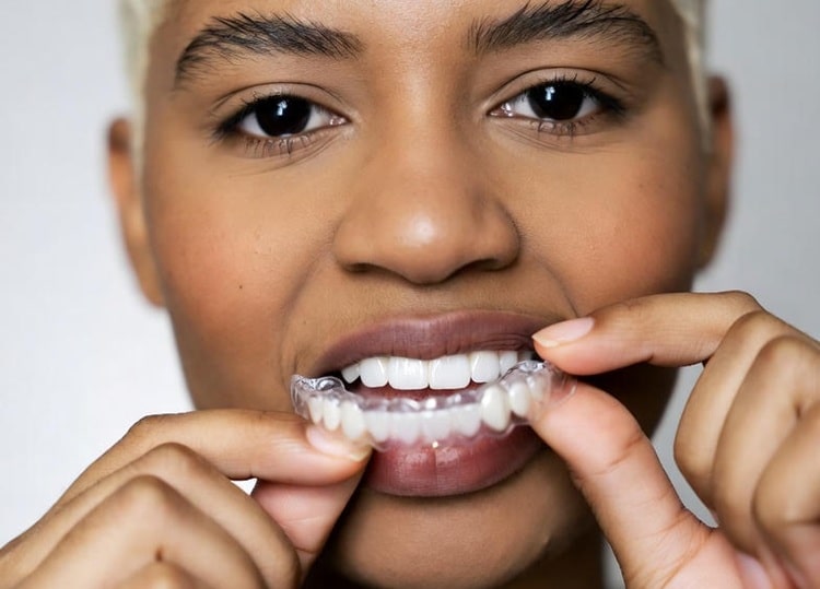 a woman putting Invisalign on her teeth