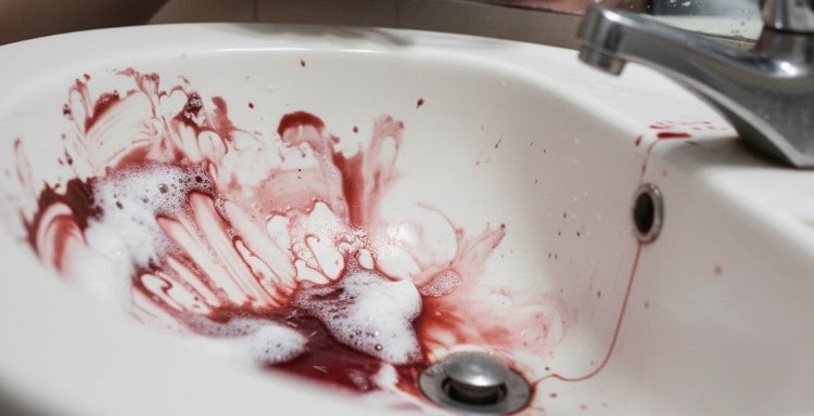 a sink full of blood as a result of bleeding gums when brushing