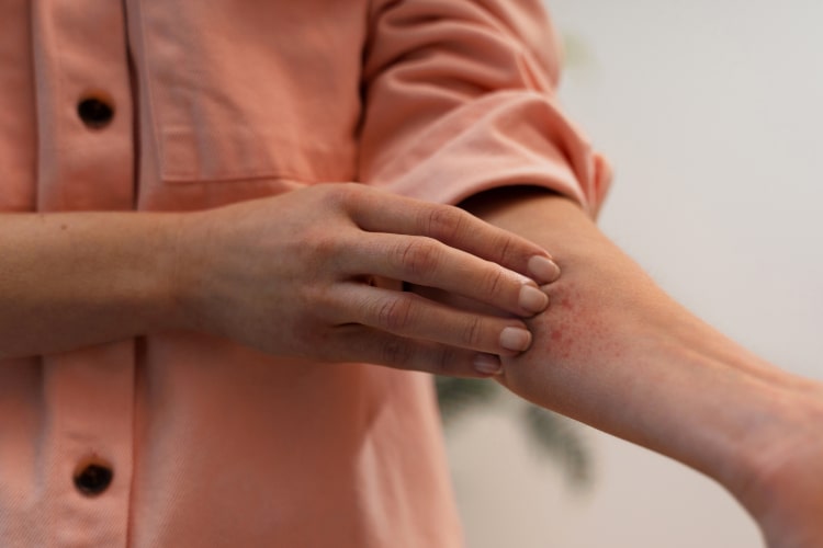 A person scratching their hand, which has become red