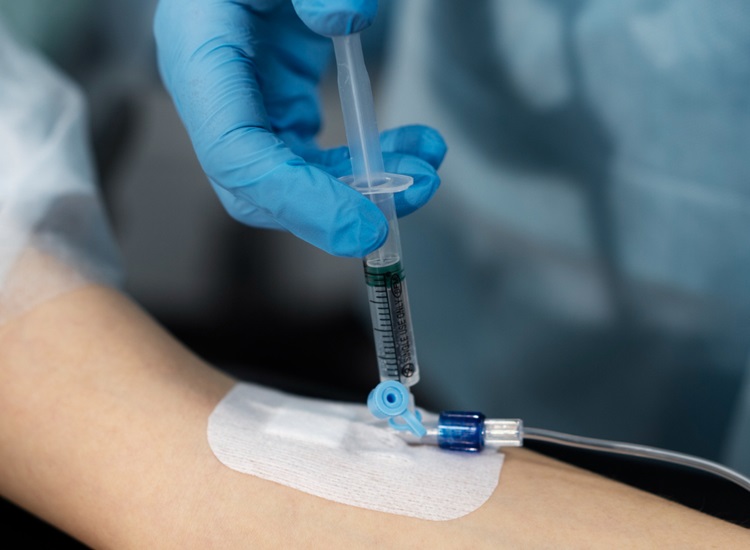 IV Sedation by dentist