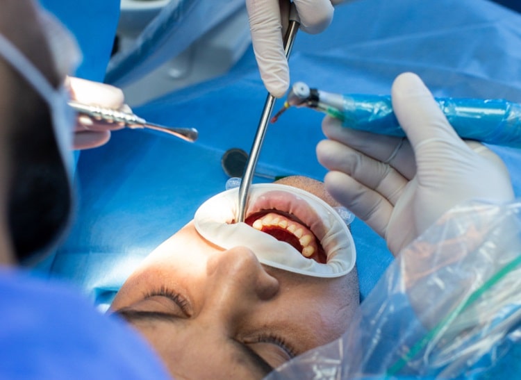 oral surgery is being done by dentist