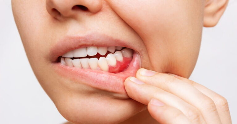 Tooth Infection Emergency: Symptoms That Require Immediate Attention