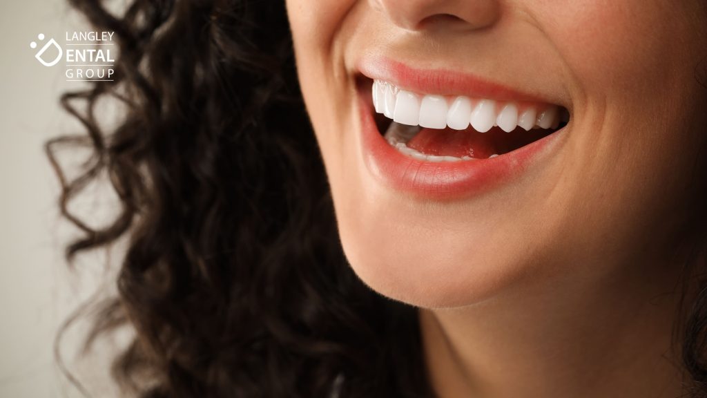 dental treatments in Langley