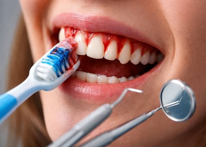 emergency dental situation