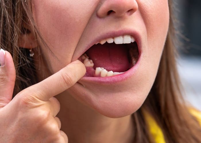 a woman losing a tooth