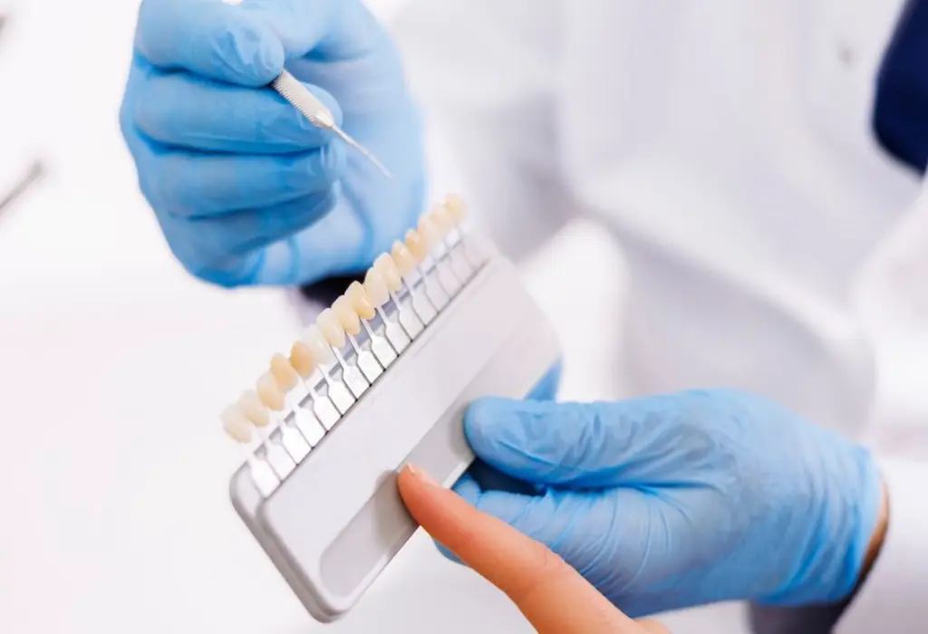 dental bonding langley