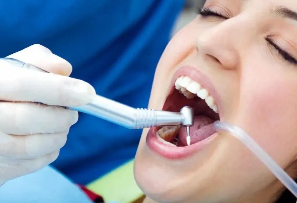 dental filling langley