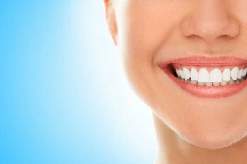 gummy smile langley